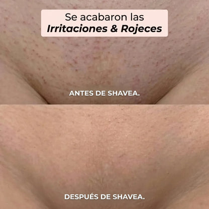 Maquinilla 2 en 1 para Bikini y Cuerpo Shavea™