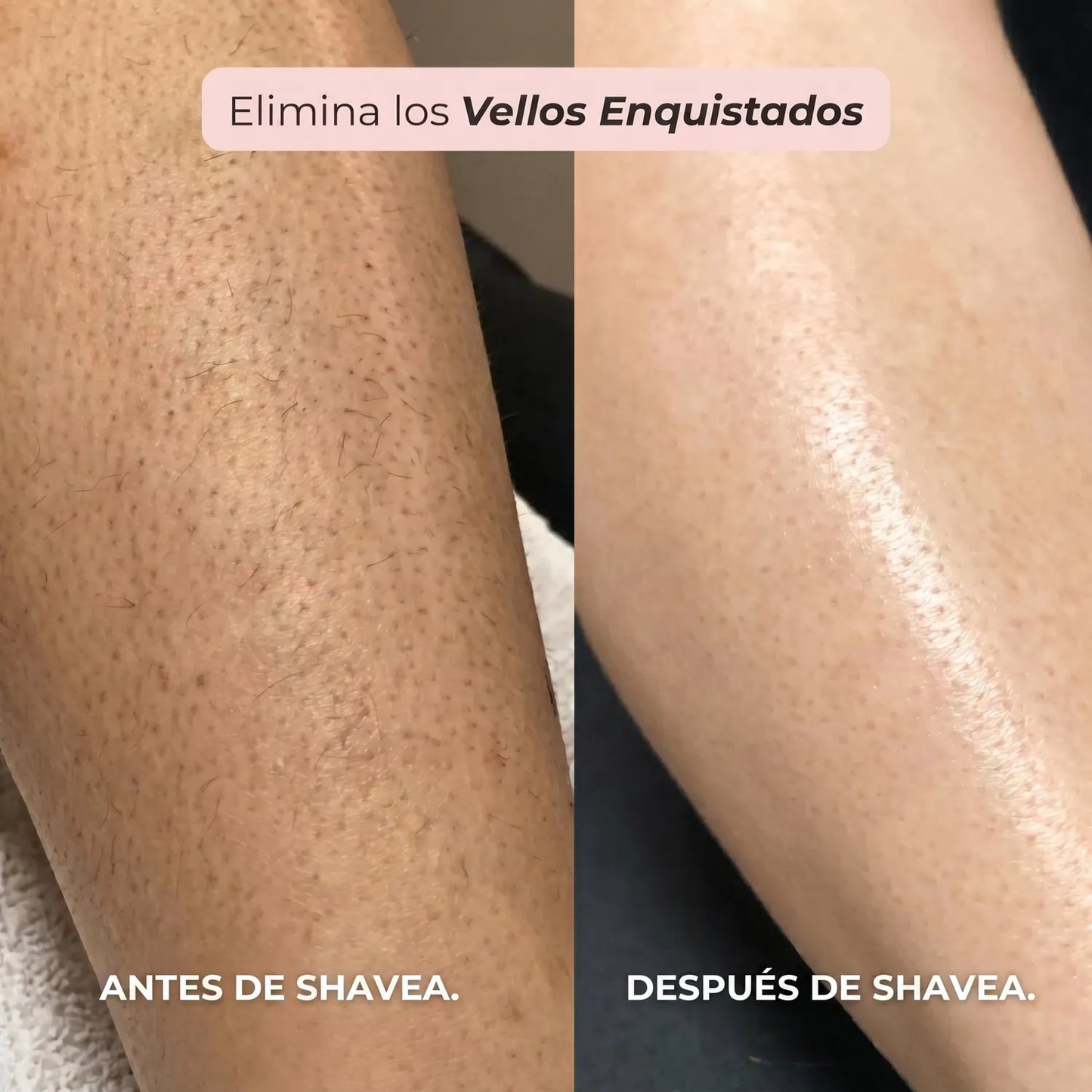 Maquinilla 2 en 1 para Bikini y Cuerpo Shavea™